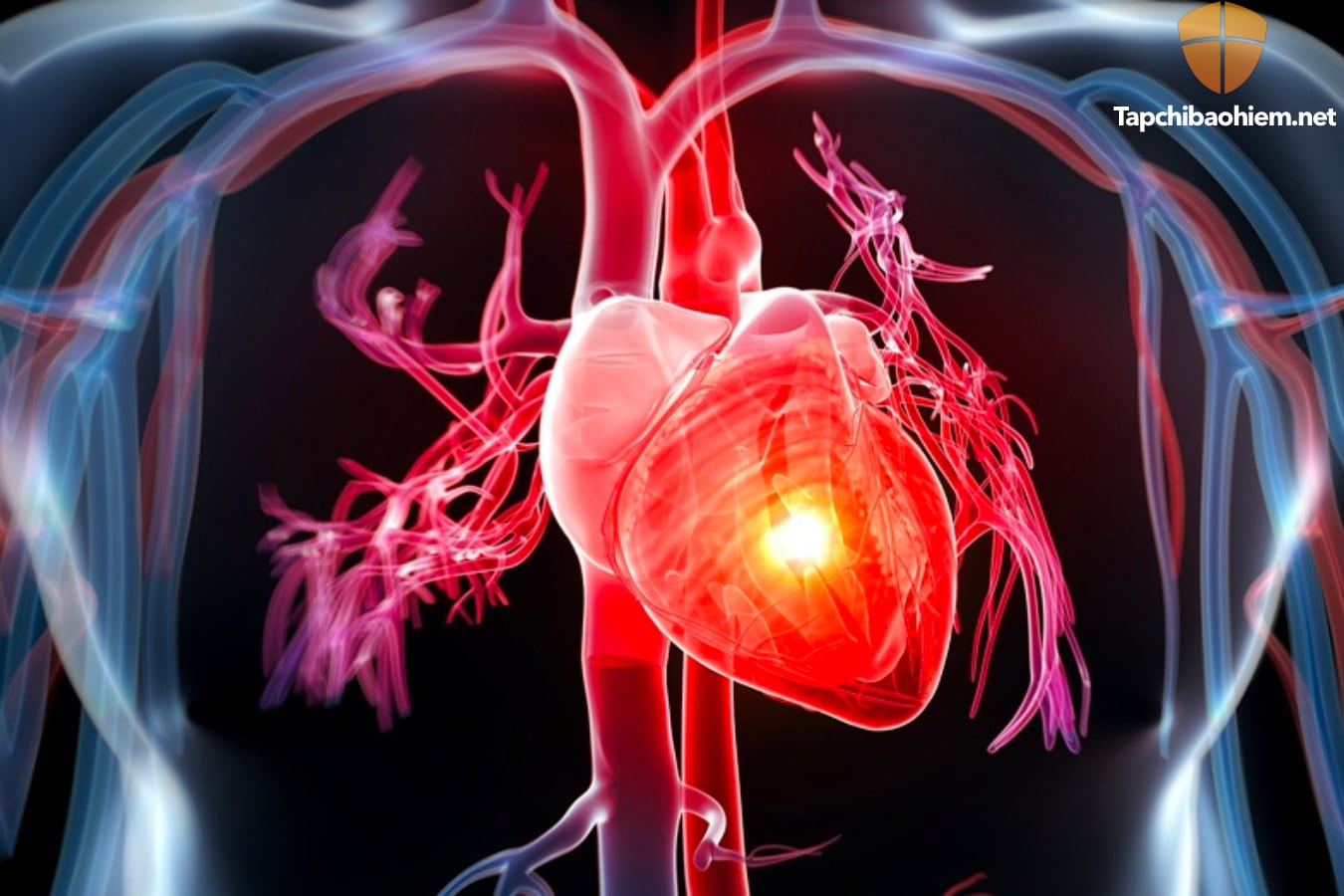 Bệnh suy tim là gì? nguyên tắc điều trị và kiểm soát bệnh suy tim